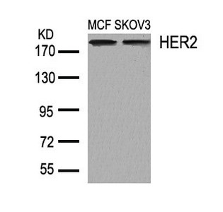 ERBB2 Antibody