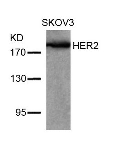 ERBB2 Antibody