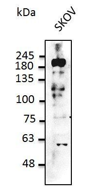 ERBB2 Antibody
