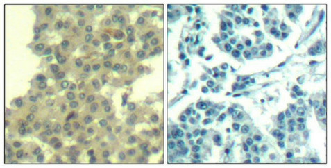 ERBB3 Antibody