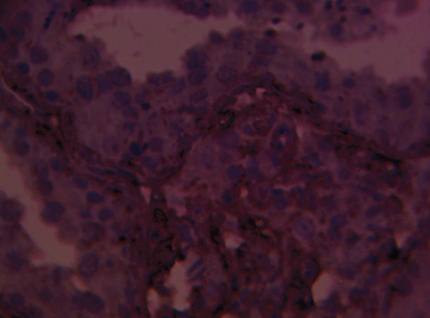 Rabbit Human ERCC1 (DNA excision repair protein) Antibody
