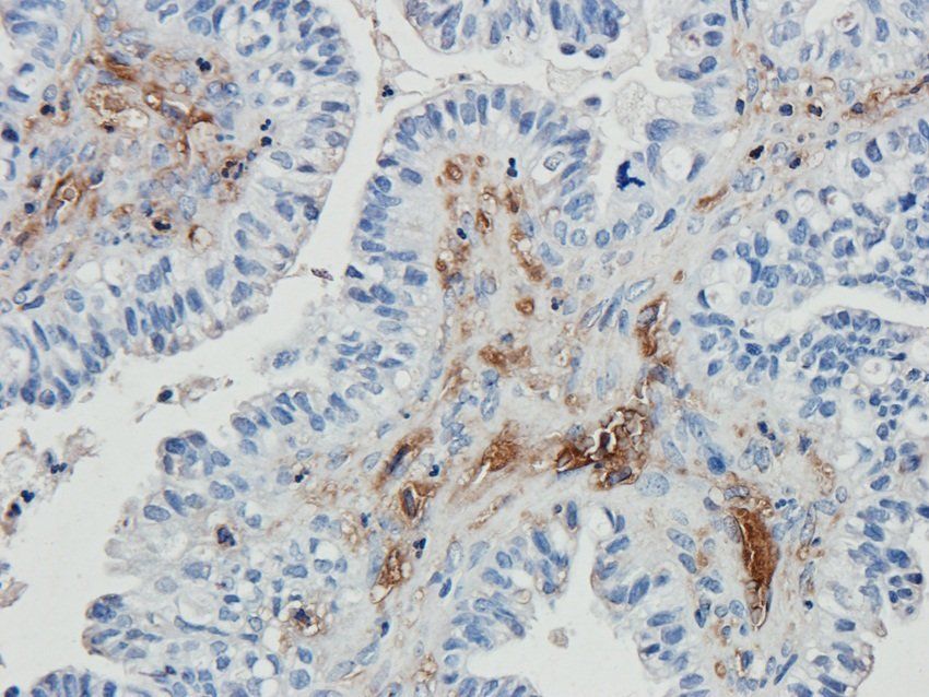 ERCC1 Rabbit Polyclonal Antibody