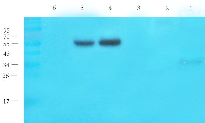 ERCC1 Rabbit Polyclonal Antibody