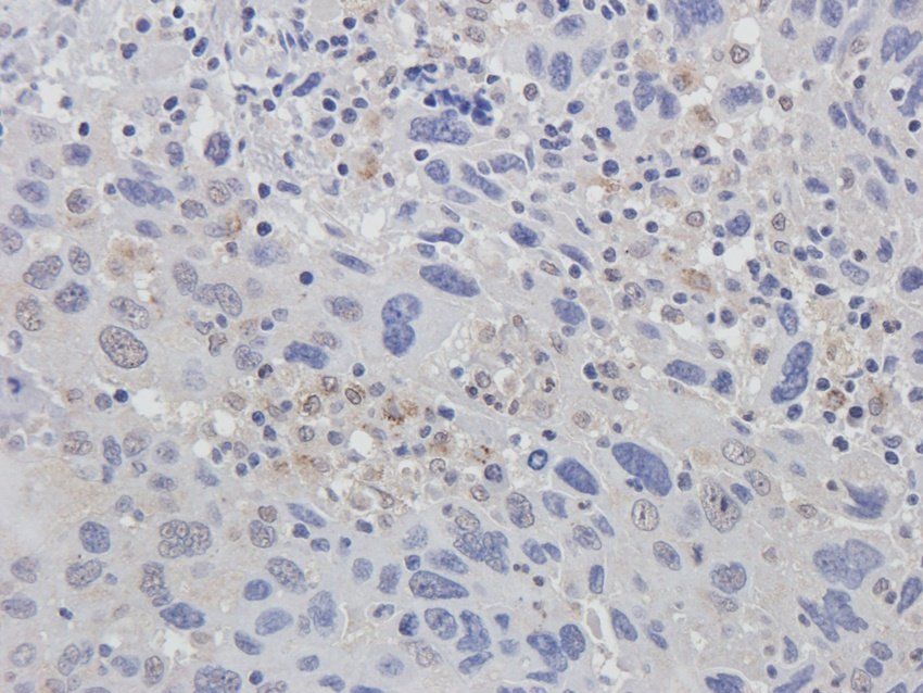 ERCC5 Rabbit Polyclonal Antibody