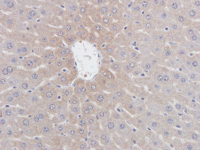 ERCC5 Rabbit Polyclonal Antibody