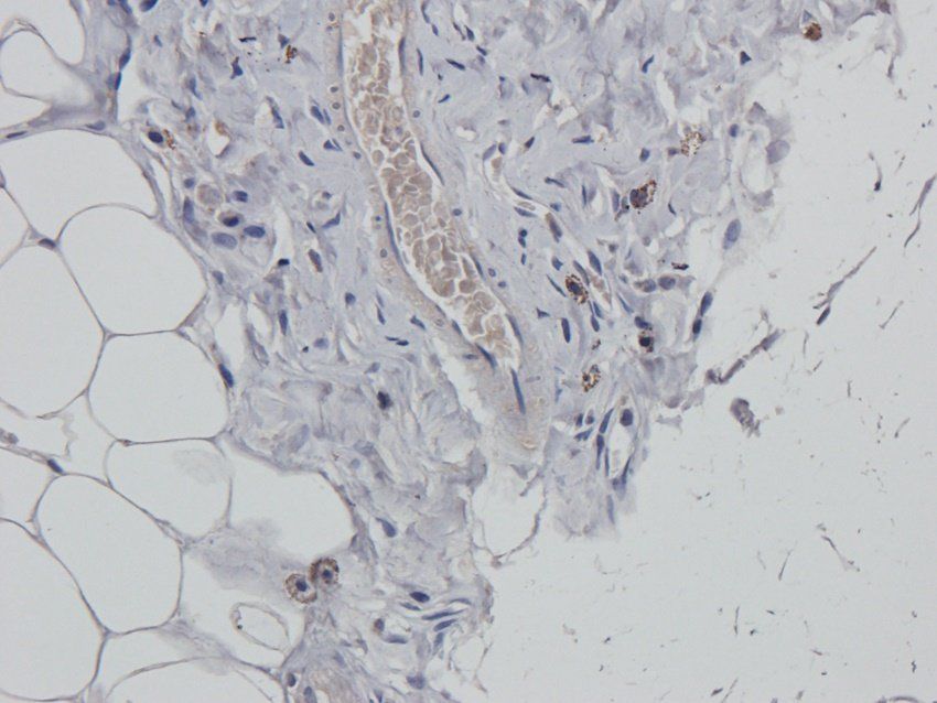ERCC5 Rabbit Polyclonal Antibody