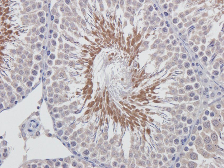 ERCC5 Rabbit Polyclonal Antibody