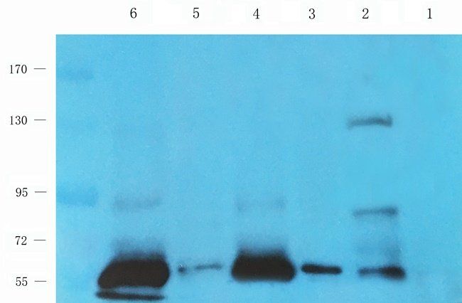 ERCC5 Rabbit Polyclonal Antibody