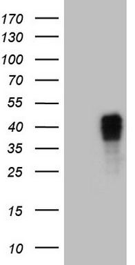 ERCC8 Antibody