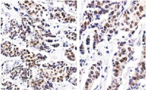ESR1 Antibody