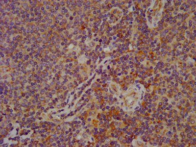 ESYT2 Antibody