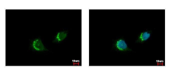 ETEA Rabbit Polyclonal Antibody