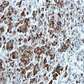 ETEA Rabbit Polyclonal Antibody