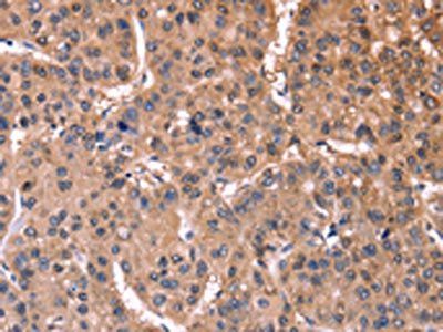 ETFB Antibody