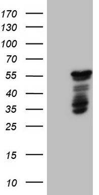 ETV7 Antibody
