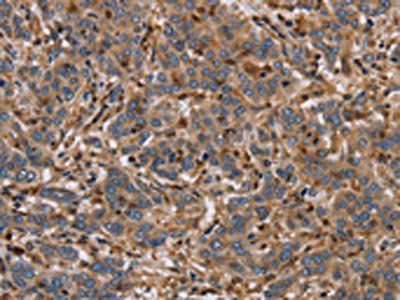ETV7 Antibody
