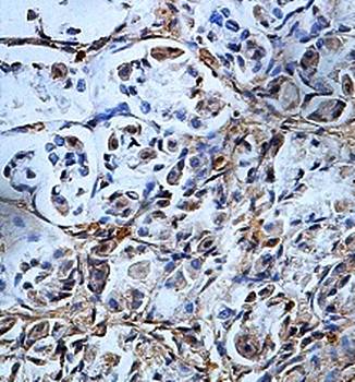 EVI5L Rabbit Polyclonal Antibody