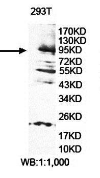 EVI5L Rabbit Polyclonal Antibody