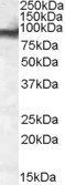 EWS/EWSR1 Antibody