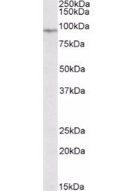 EWS/EWSR1 Antibody