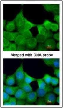 EXOC7 Rabbit Polyclonal Antibody