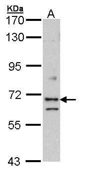 EXOC7 Rabbit Polyclonal Antibody