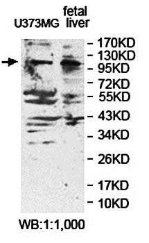 EXTL3 Rabbit Polyclonal Antibody