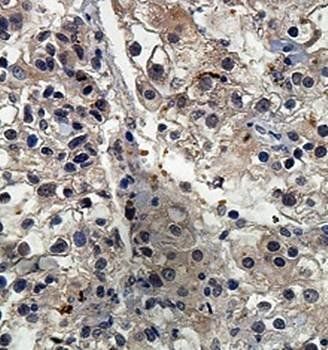 EXTL3 Rabbit Polyclonal Antibody