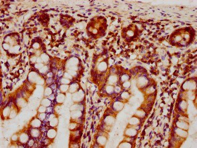 EZR Antibody