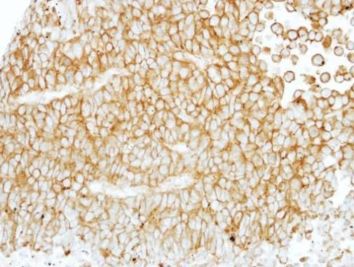 adhesion G protein-coupled receptor E1 Antibody