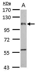 adhesion G protein-coupled receptor E1 Antibody