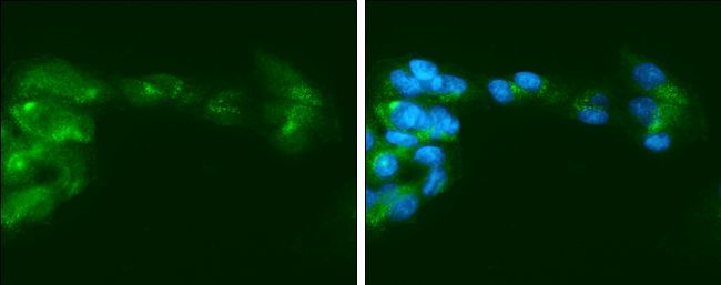 coagulation factor IX Antibody