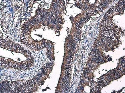 coagulation factor IX Antibody