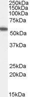 ETEA/UBXD8 Antibody