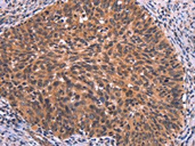 FAIM Antibody