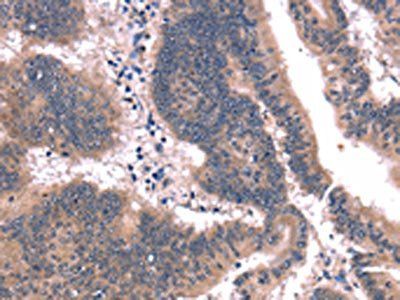 FAIM Antibody