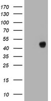 PTK2 Antibody