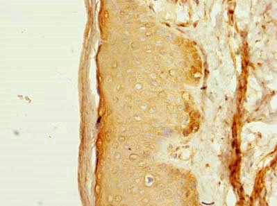 FAM118A Antibody