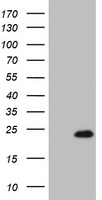 FANCC Antibody