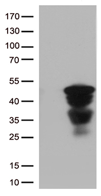 FANCC Antibody