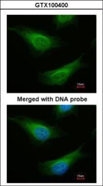 FA complementation group C Antibody