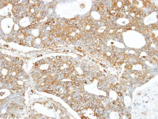 FA complementation group C Antibody
