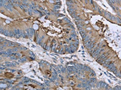 FANCG Antibody