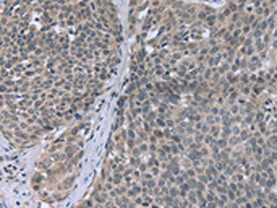 FANCG Antibody