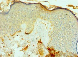 FAP Antibody