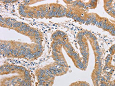 FARSB Antibody