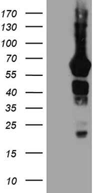 FARSB Antibody