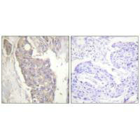 FAS Antibody