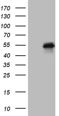 FSCN1 Antibody