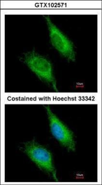 FAST Rabbit Polyclonal Antibody